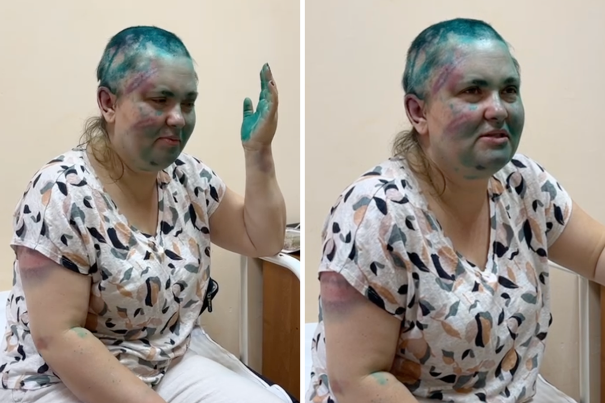 В деле нападения на Милашину и Немова усмотрели «характерный почерк западных спецслужб»
