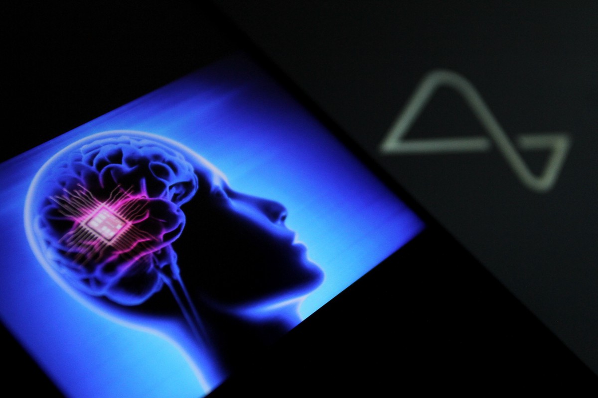 Маск: Использование мозговых имплантов Neuralink в будущем станет нормой жизни