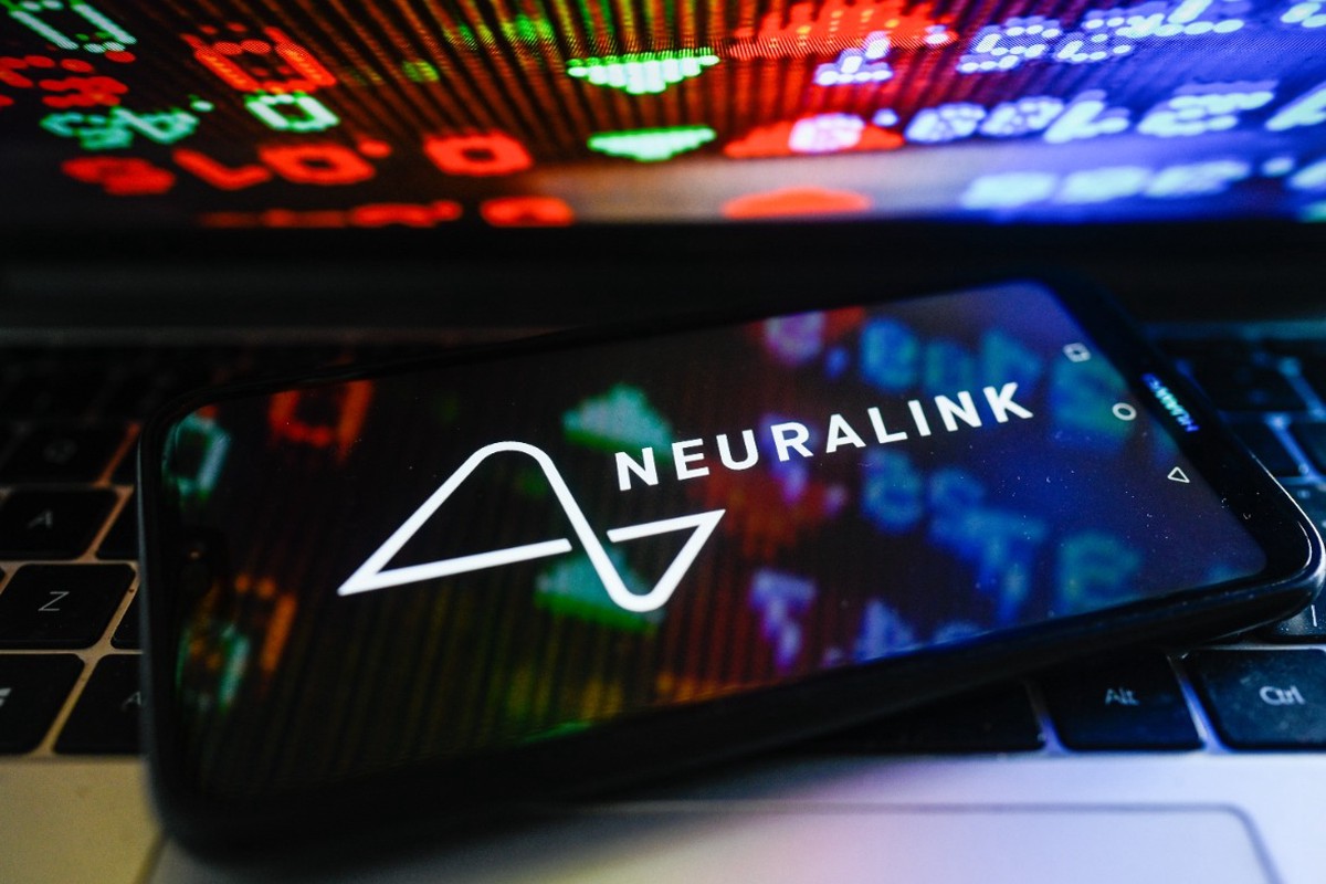 Маск: Новый имплант Neuralink подарит зрение даже слепым от рождения людям