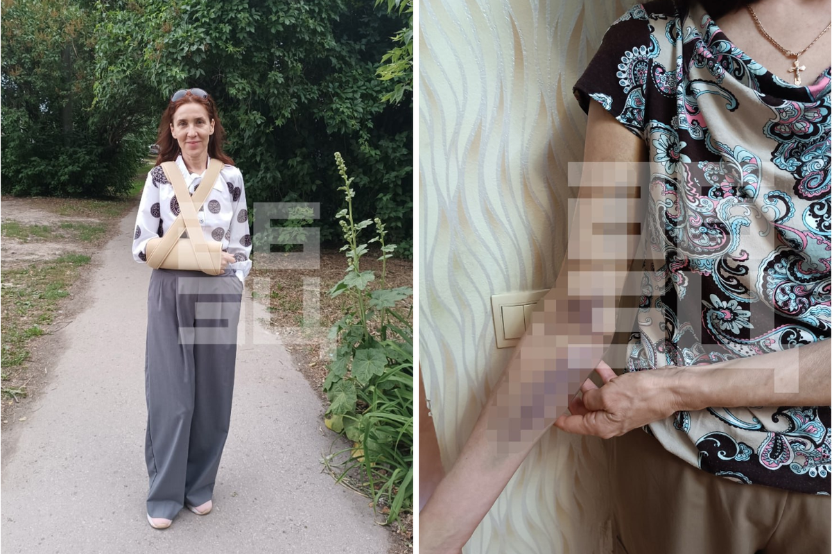 Приняли за закладчицу: полицейские сломали руку жене участника СВО, фотографировавшей цветы