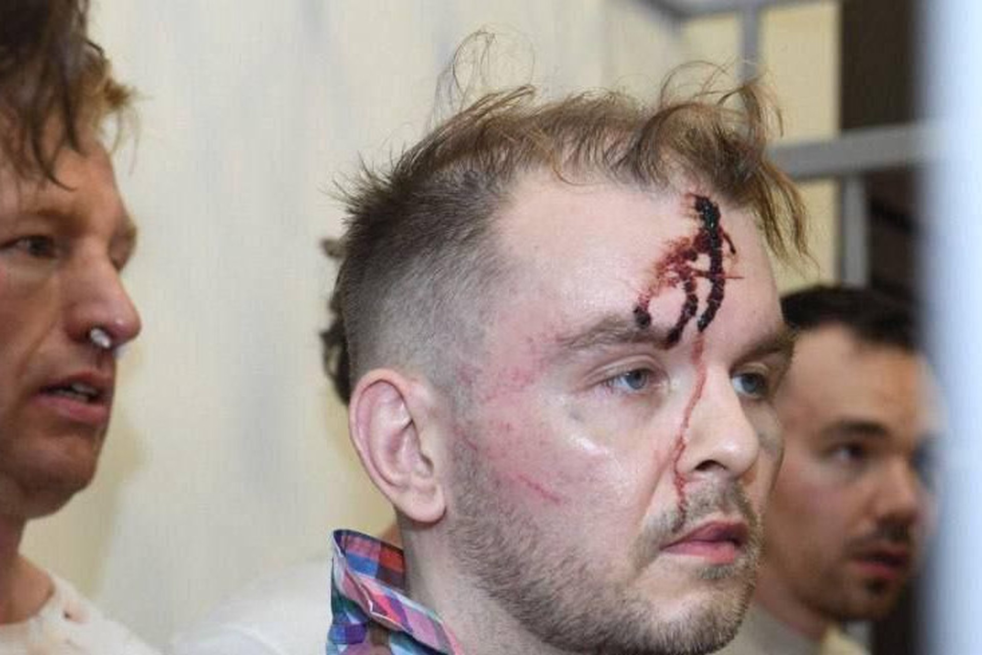 Криминалист не исключил нанесения ударов рукояткой пистолета по задержанным в Баку россиянам
