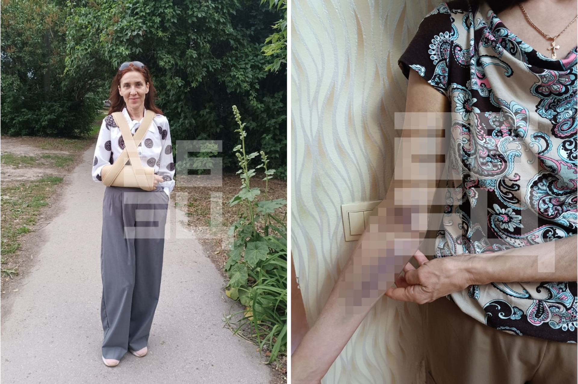 Приняли за закладчицу: полицейские сломали руку жене участника СВО, фотографировавшей цветы