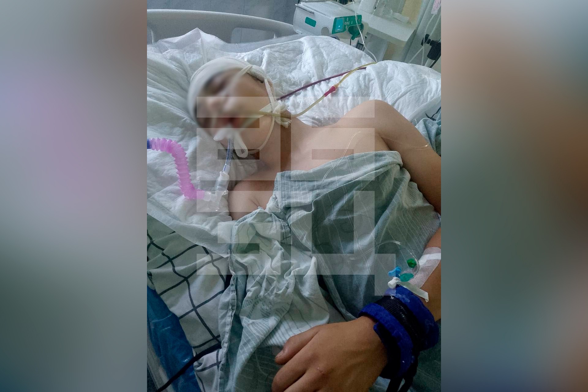 Подросток 10 дней находится в коме после жестокого избиения бандой в Башкирии