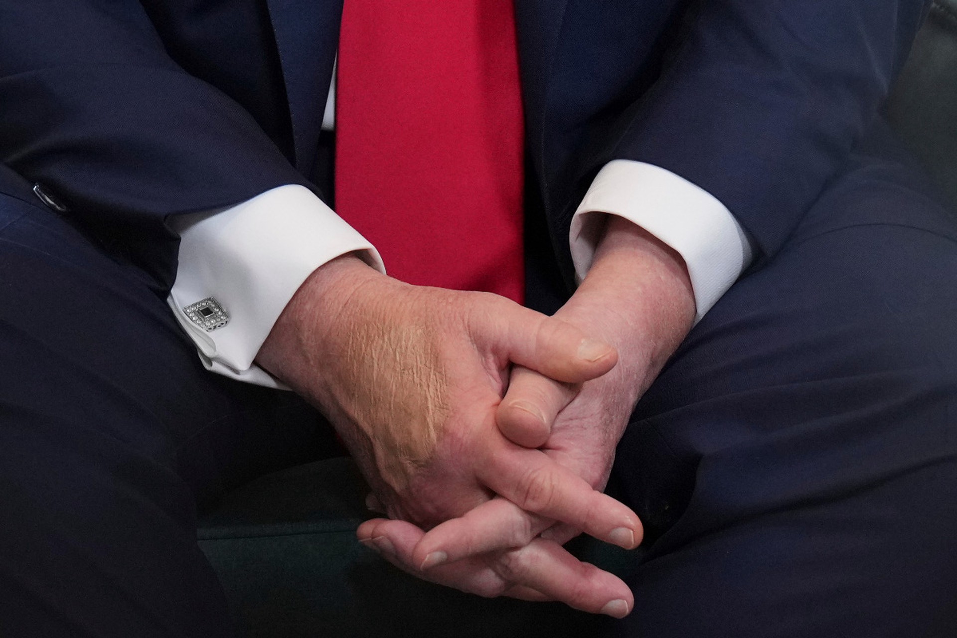 Independent: Трамп покрыл руки консилером во время поездки в Шотландию
