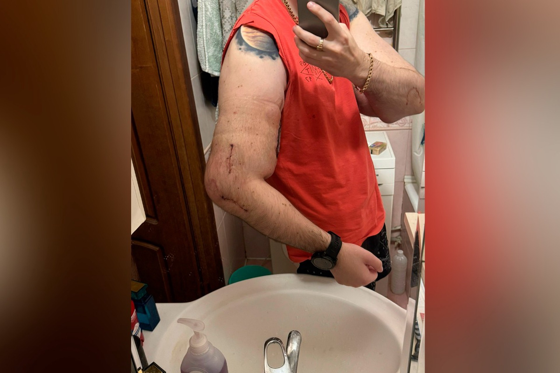 «Сократил жизнь лет на 20»: блогера Руки-Базуки могут ждать деменция или аутоиммунное заболевание