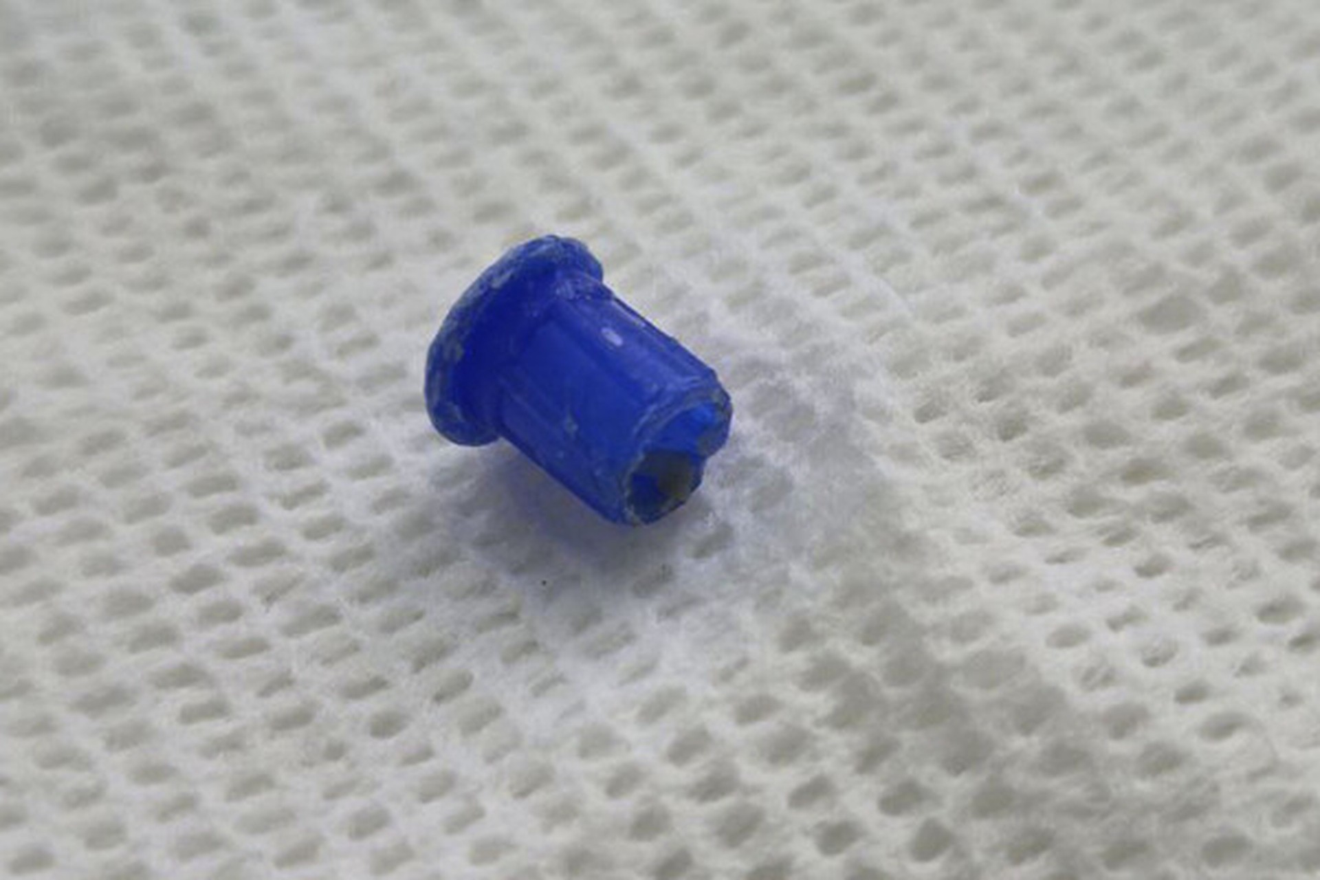 В Нижнем Новгороде 13-летний школьник три недели ходил с колпачком от ручки в легком