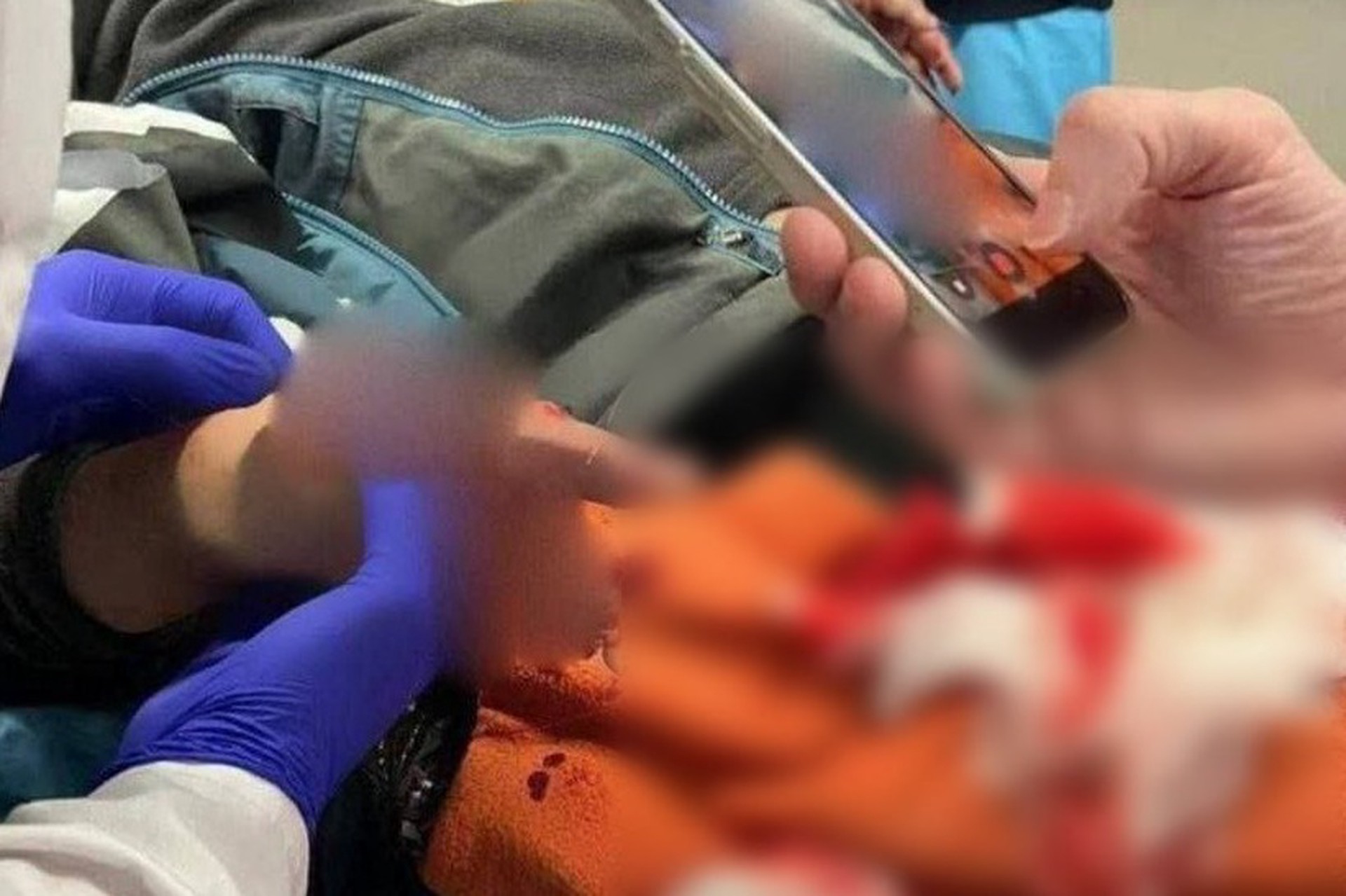 После взрыва в Красногорске возбуждено уголовное дело