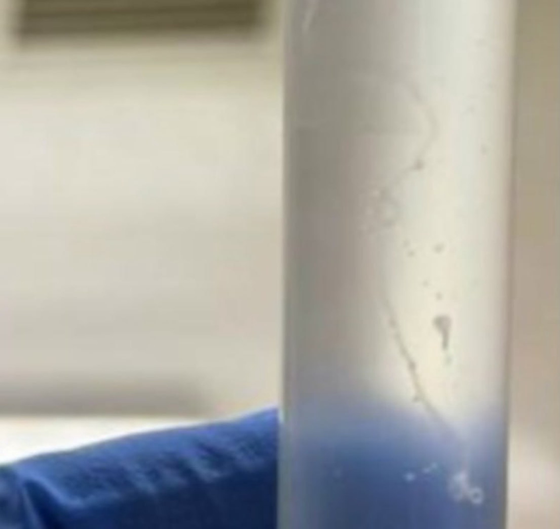 У жительницы Омска из глаза удалили живого червя