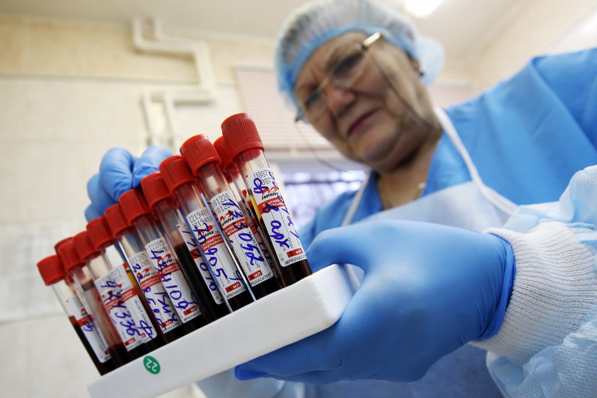 Названо число зараженных ВИЧ-инфекцией россиян