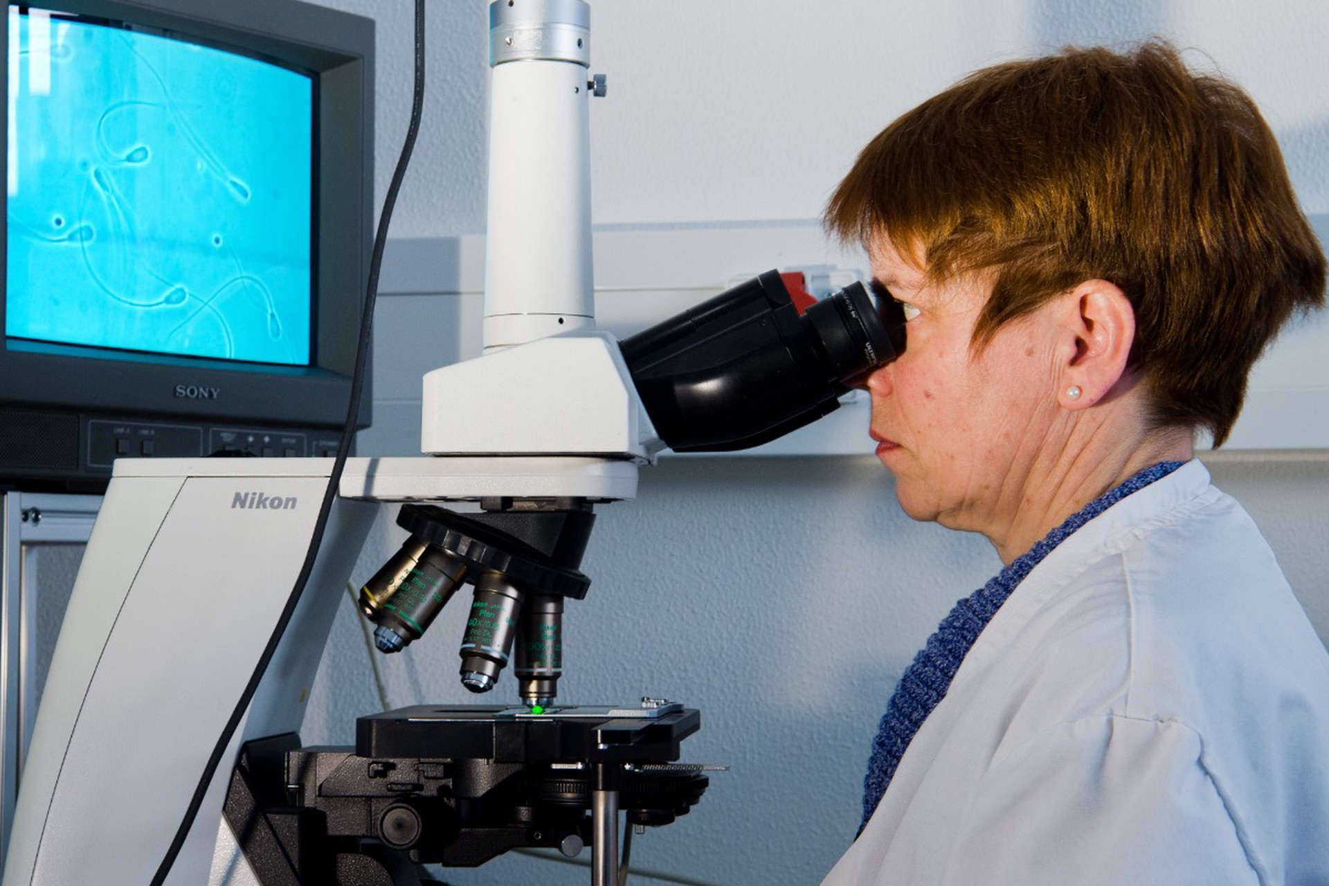 Донор с генетической мутацией стал отцом почти 200 детей