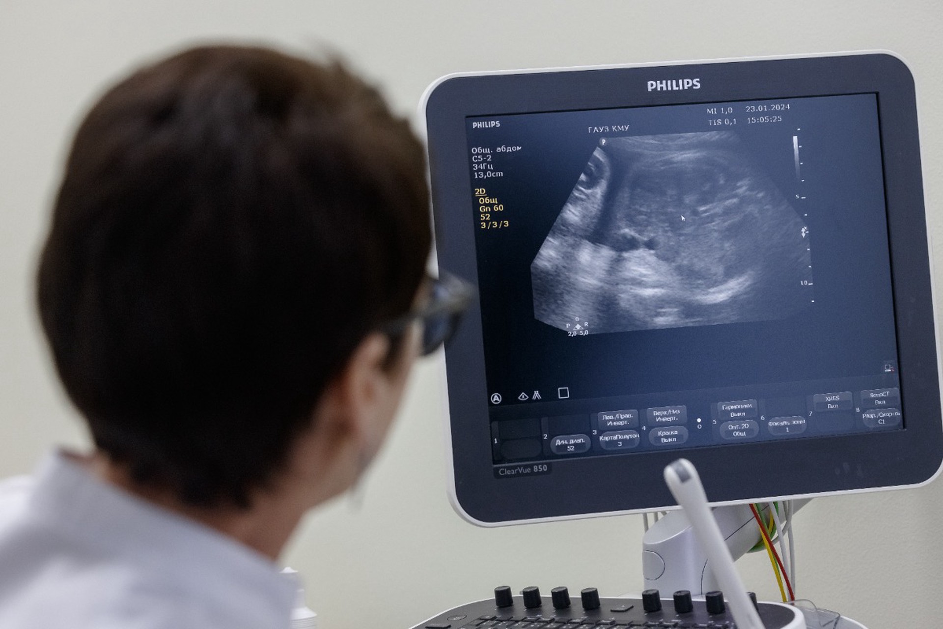 Убивать и убывать? Почему принимаемых в России мер против абортов недостаточно