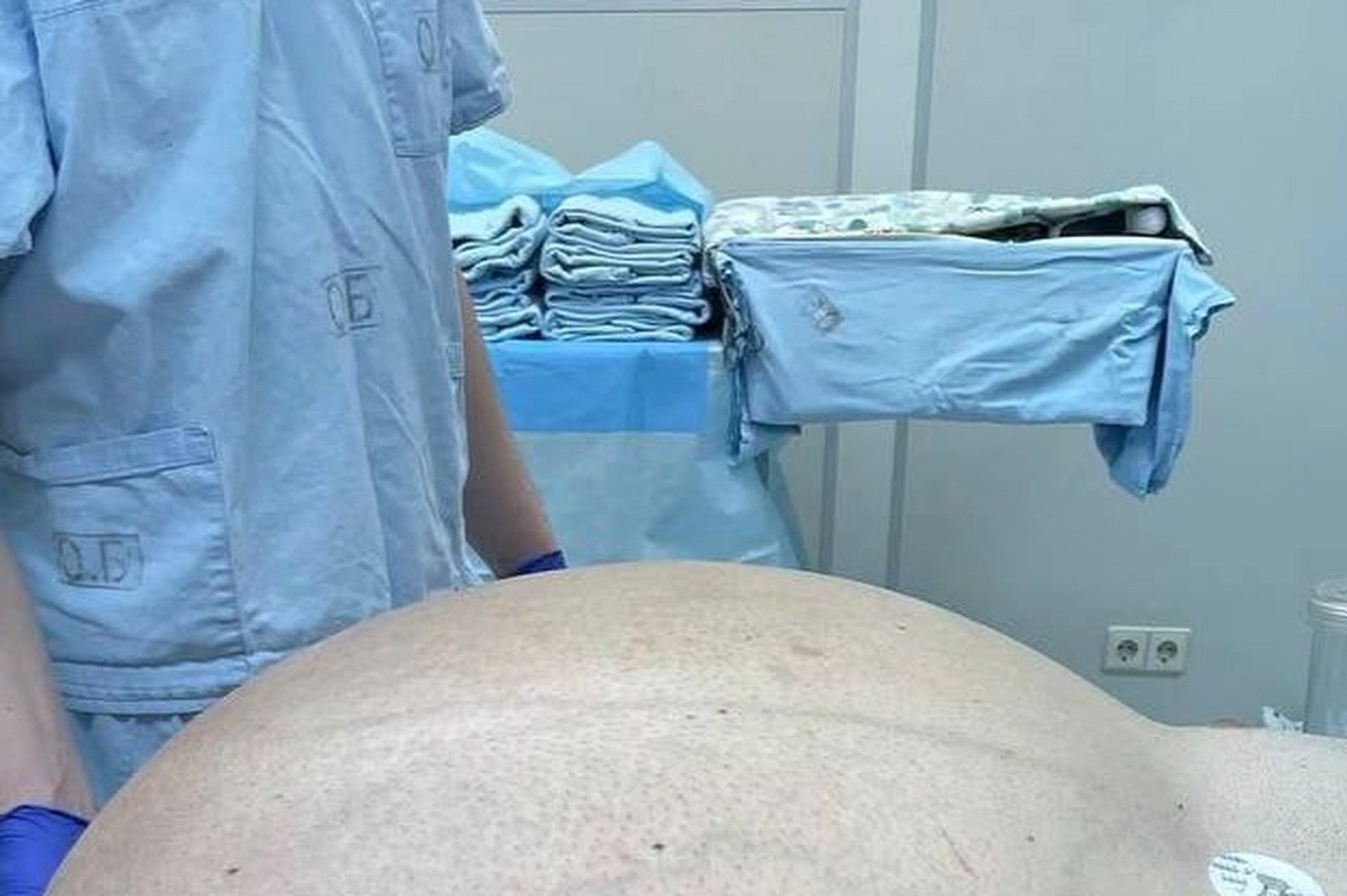 Опухоль массой 60 кг обнаружили в животе у россиянина