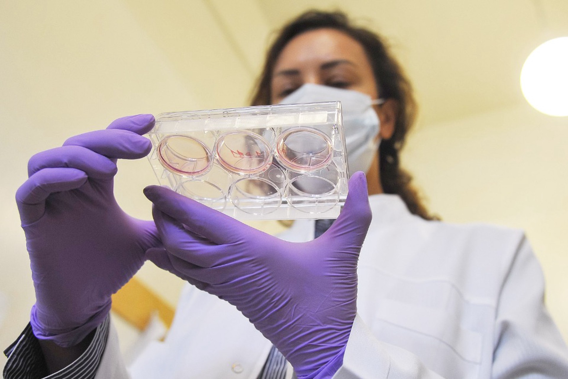 Оспу обезьян заподозрили у пациента в Подмосковье