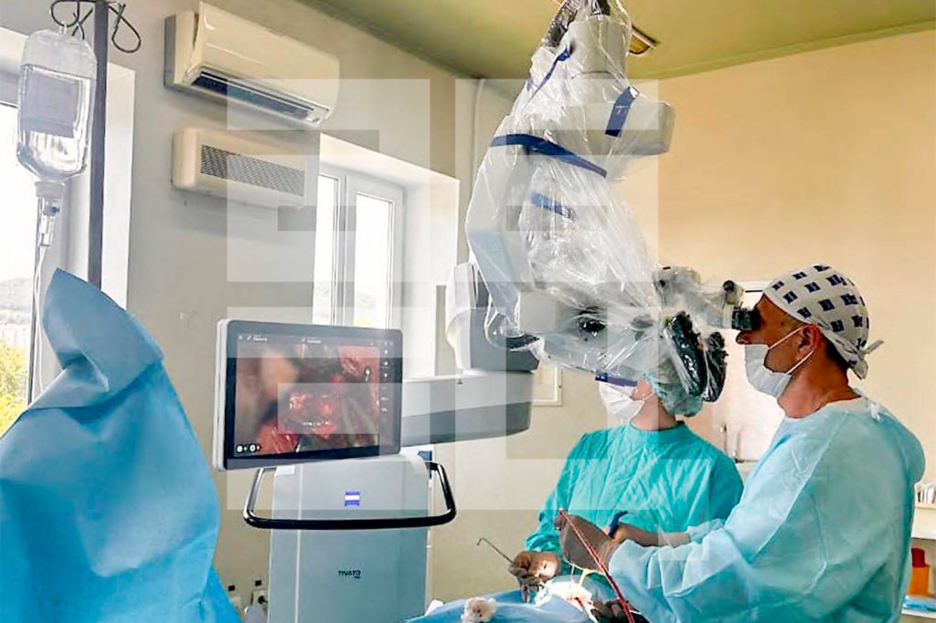 Опухоль размером с кулак удалили нейрохирурги из мозга россиянки