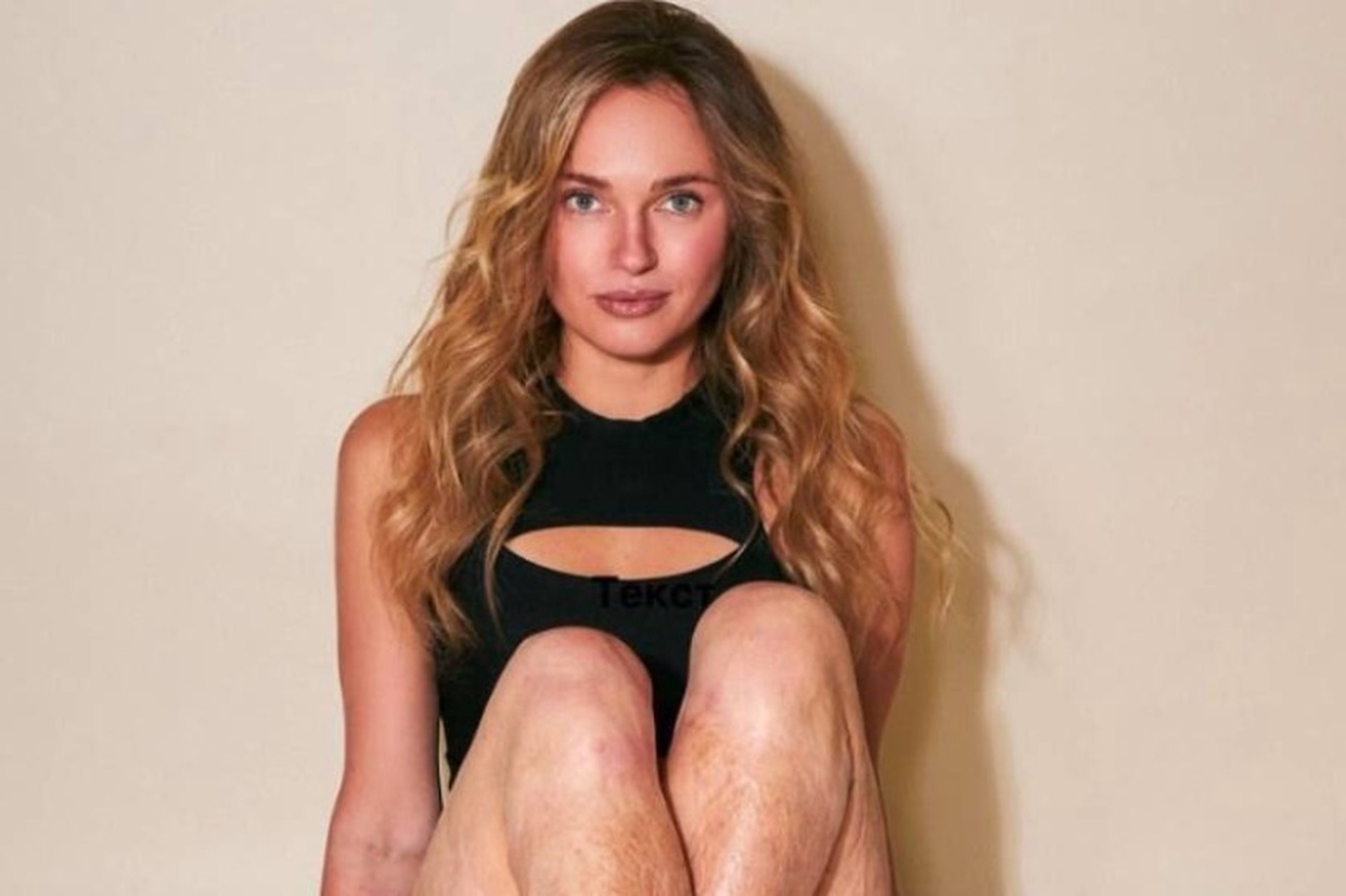 Россиянку без пальцев на ногах унизили в аэропорту Стамбула