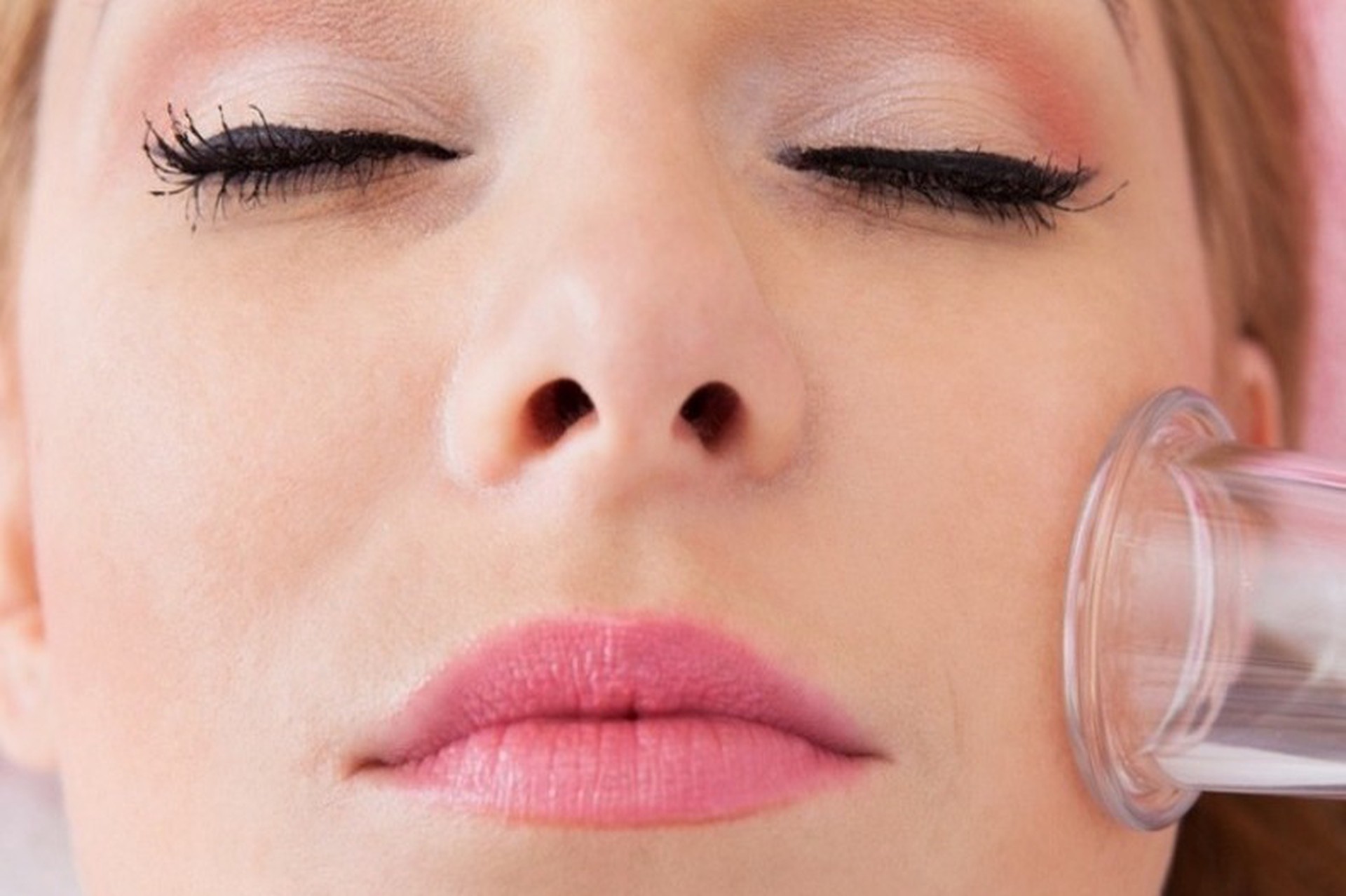 Врач предупредила о риске остаться без глаза из-за «омоложения» пылесосом