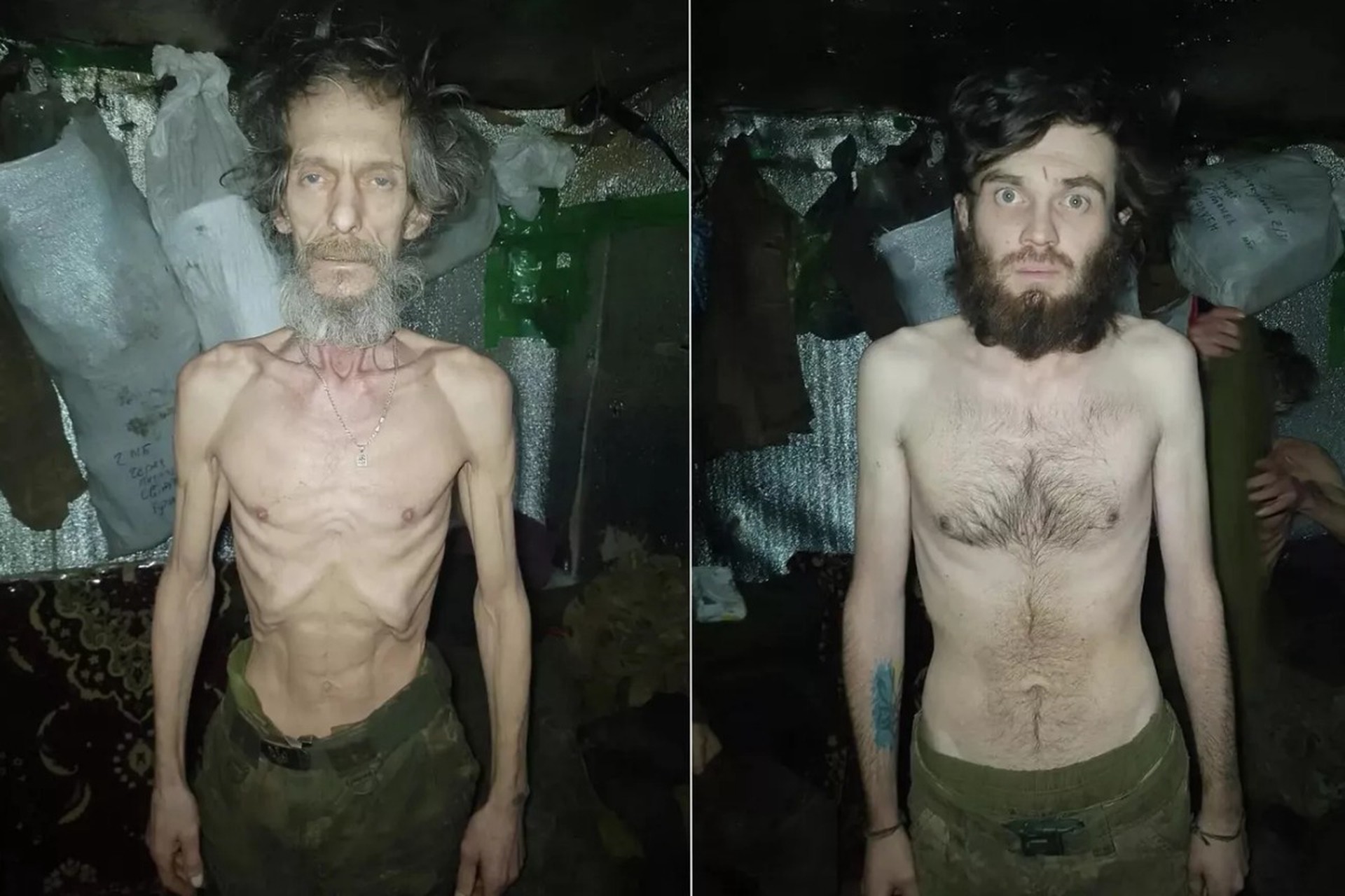 Украинские военные массово публикуют ужасающие фото голодающих солдат