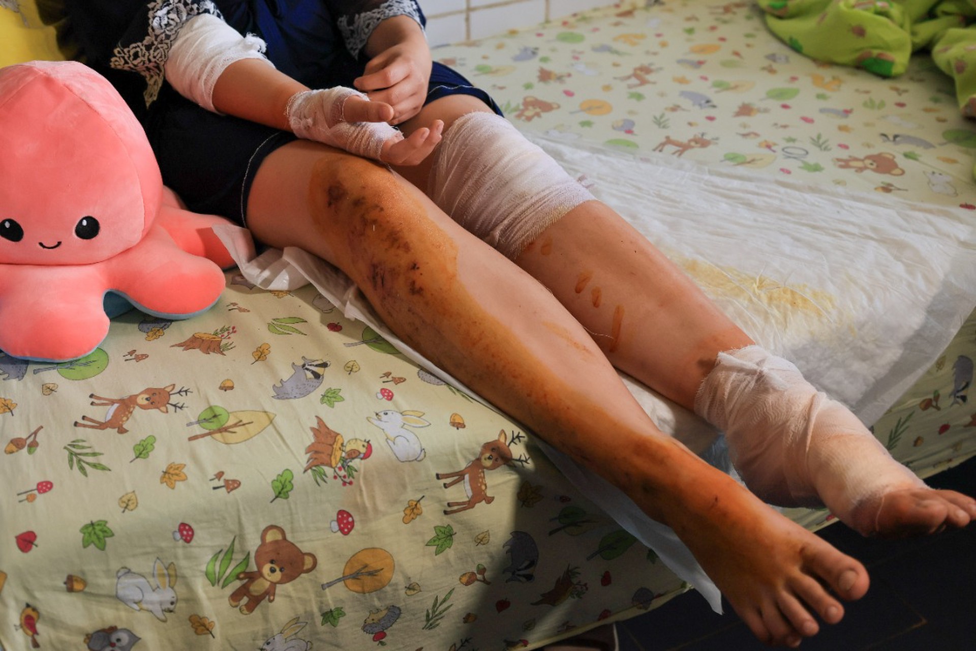«Ждали, когда дети побегут»: Лантратова – о чудовищной тактике ВСУ в Старобельске