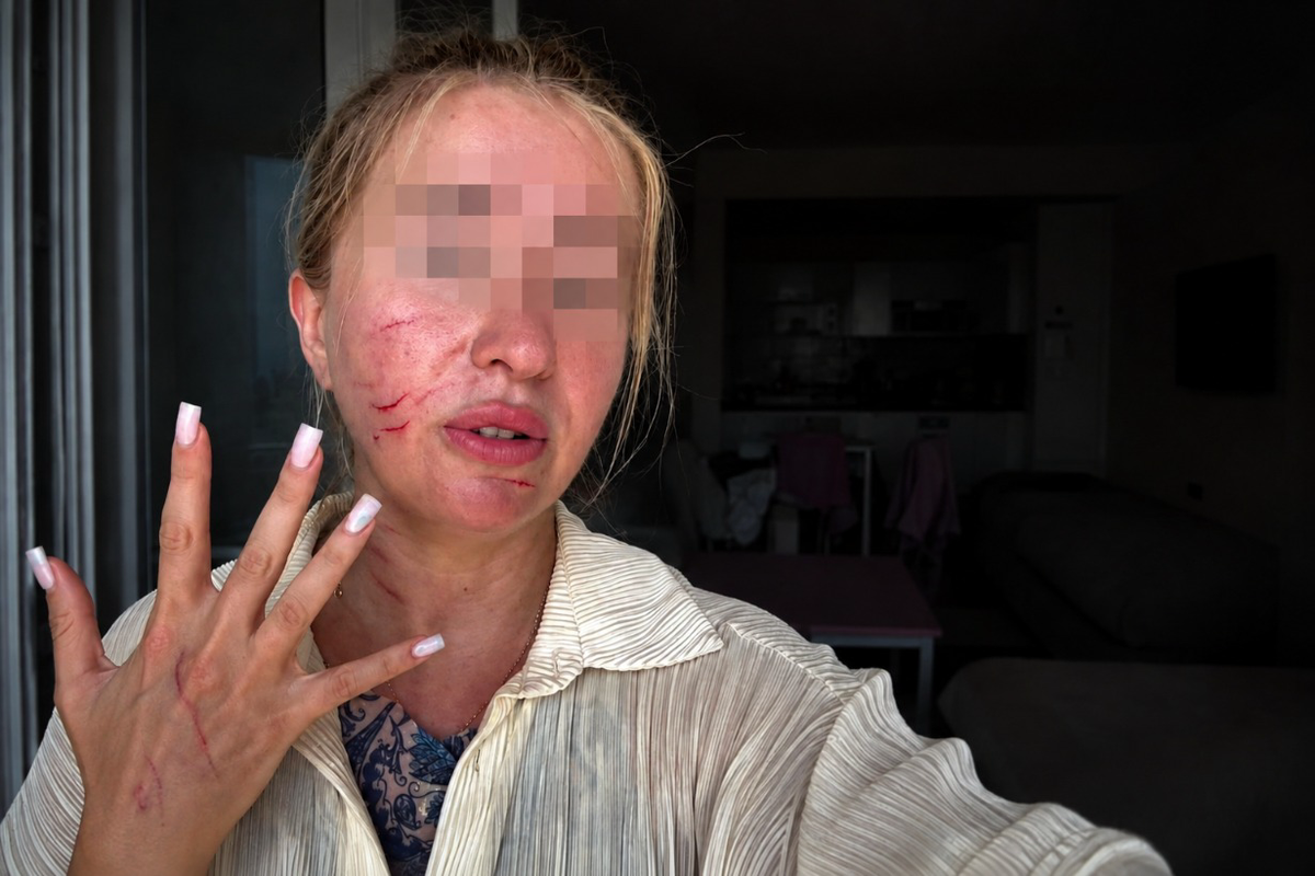 Ревнивая турчанка избила россиянку на пляже из-за мужа